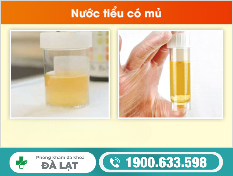 Hình ảnh minh họa